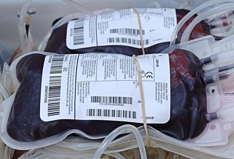 Ασκοί συλλεγμένου αίματος μετά από αιμοδοσία